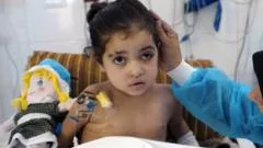 Girl has multiple surgeries to control infections after strike in Gaza