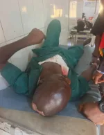 APC chieftain hospitalised after alleged attack by thugs in Delta