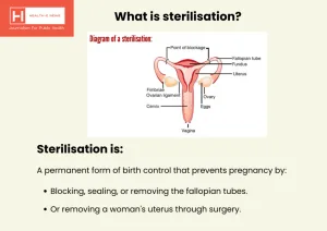 Forced or coerced sterilisation: Know your rights about consent