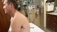 Man impaled by a hiking pole treks 10 miles down mountain