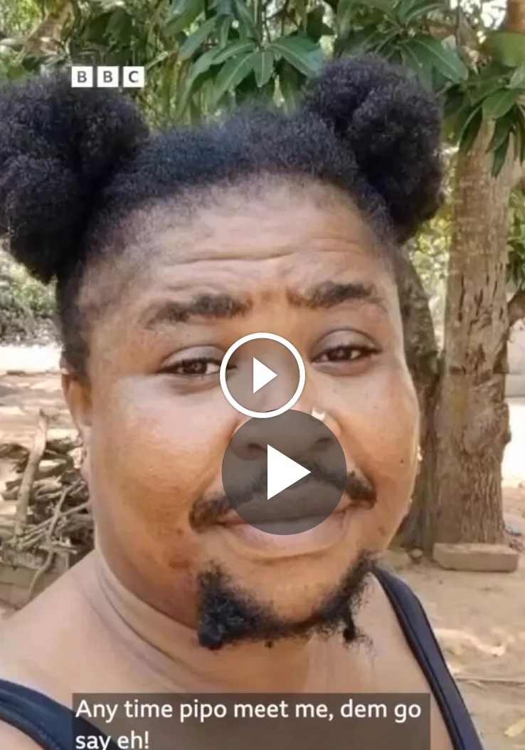 VIDEO: I’m a woman but i …… Lady reveals Hirsutism condition